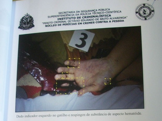 Foto da perícia mostra mão esquerda de Marcelo perto de arma. Advogada quer saber por que há lesões que não foram citadas pelos peritos (Foto: Reprodução)